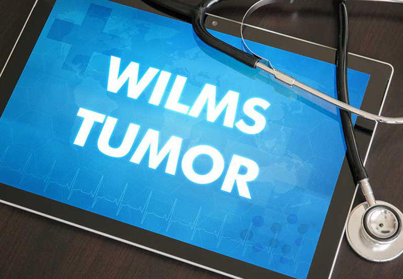 Wilms-tumor-a-genitourinary-tumor-Dr.-Elias-Wehbi